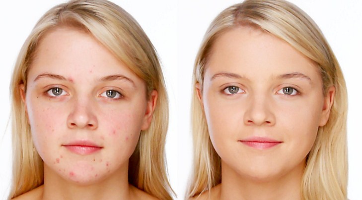кожа до и после применения
