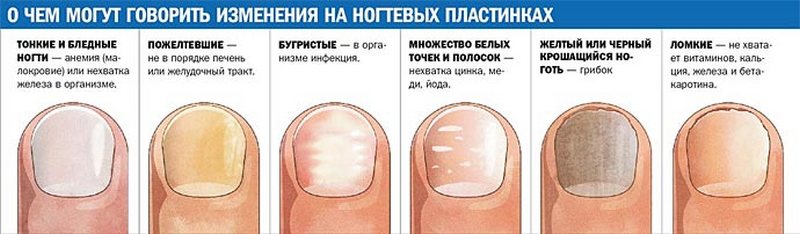 Что делать если появилось пятно на ногте большого пальца ноги
